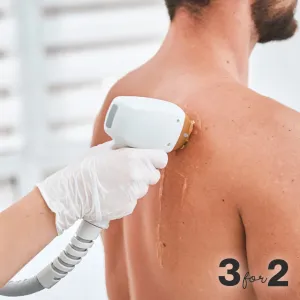 3 for 2 Back Man Hair Removal