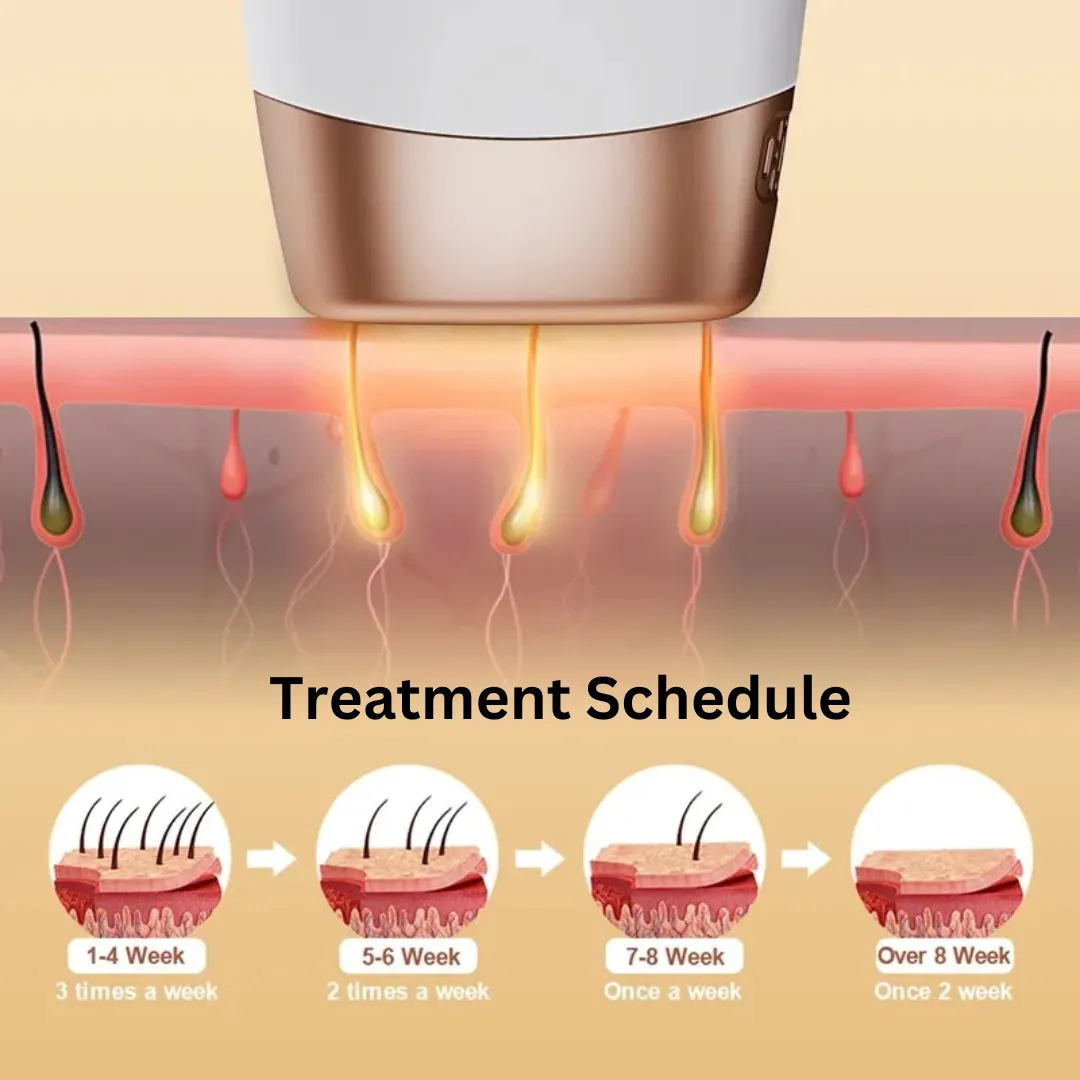 Bare-Allure IPL Device