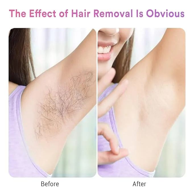 One Beauty Ice-Cooling IPL Hair Removal